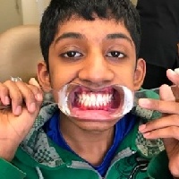 Teenage boy with smile shield in his mouth in Massapequa Park dental office