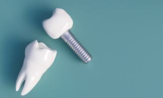 dental implant and tooth isolated on teal background