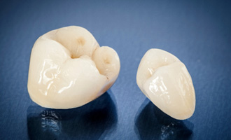 : a close-up of a dental crown