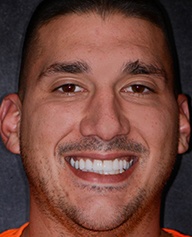 Young man smiling after visiting dentist in Massapequa Park