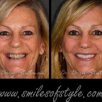 Older female patient before and after treatment from Massapequa Park dentist