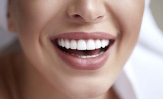 close up of Kor teeth whitening smile