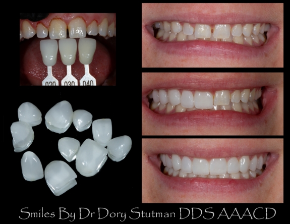Cerec machine in action