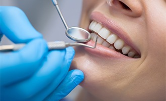 Closeup of patient receiving dental treatment