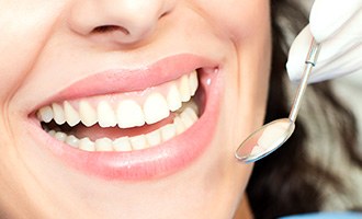 Closeup of patient receiving dental exam