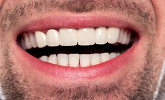 Closeup of healthy attractive smile