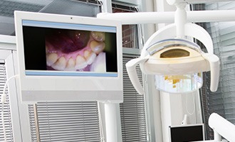 Intraoral photo on computer