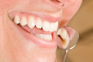 gum disease massapequa