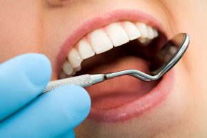 Stop Tooth Decay with a Massapequa Dentist 