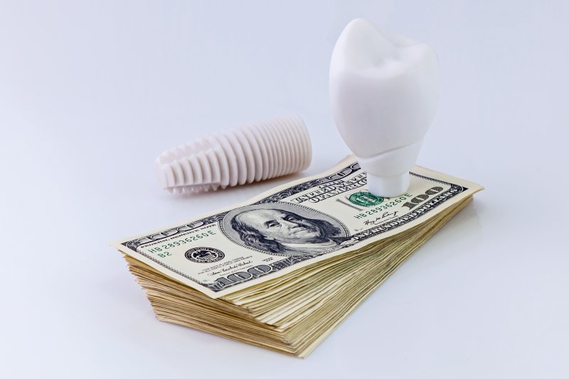 Dental implant on a stack of money