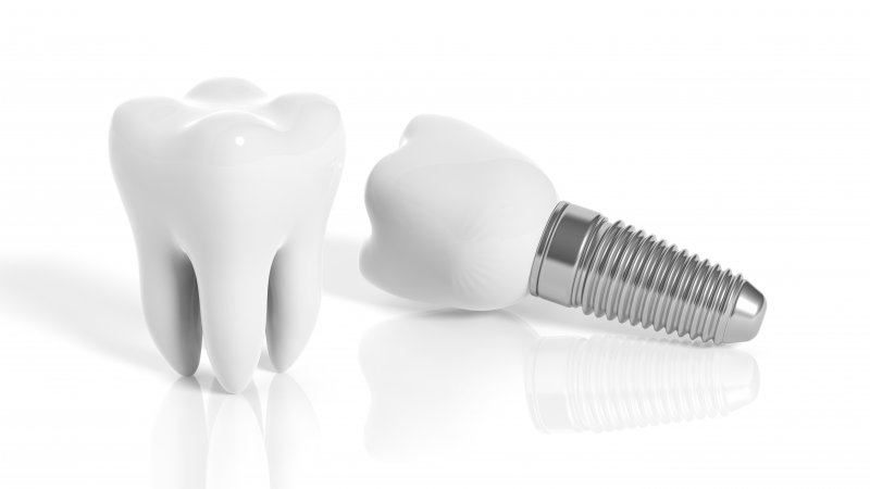 dental implant and tooth model