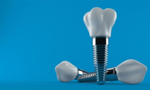 a closeup of a dental implant against a blue background